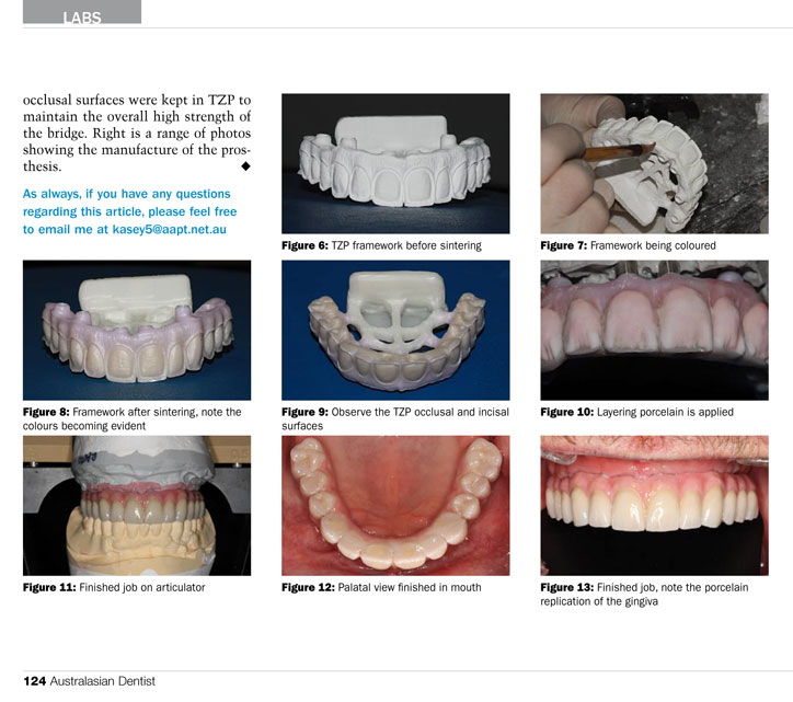 Davis Advanced Dental Prosthetics